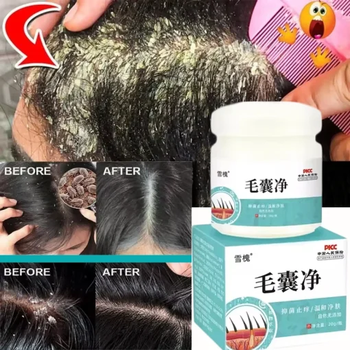 Tratamiento rápido anticaída del cabello y caspa