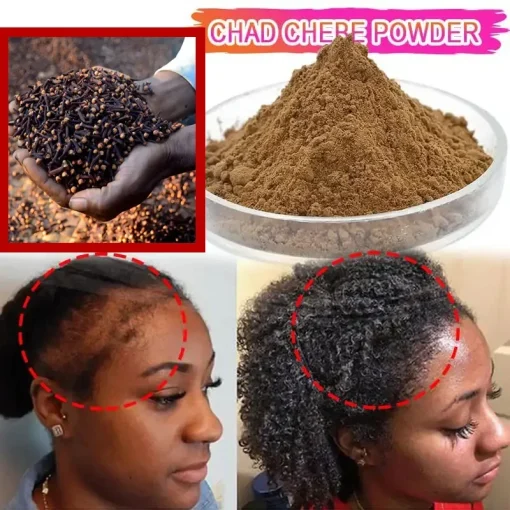 Cabello Africano Crecimiento Bordes Alopecia Tracción