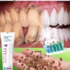 Pasta dental blanqueadora anti-sarro dental