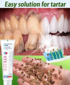 Pasta dental blanqueadora anti-sarro dental